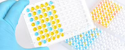 Immunoassays: Spotlight on the ELISpot Technique