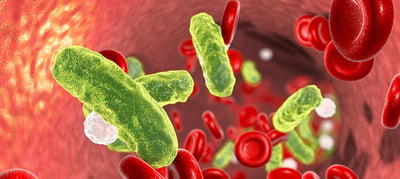 Tackling Global Sepsis: Saving Lives with Timely Infection Diagnosis