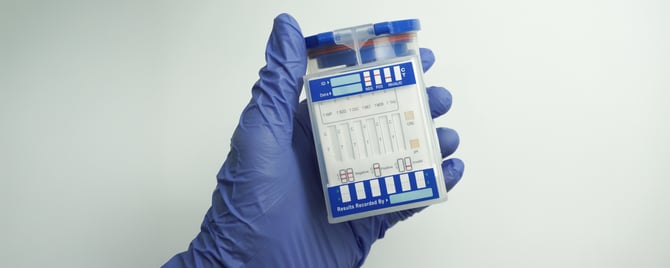 The Rise of Non‑Invasive Drug Screening: Innovations Shaping Occupational Health & Safety